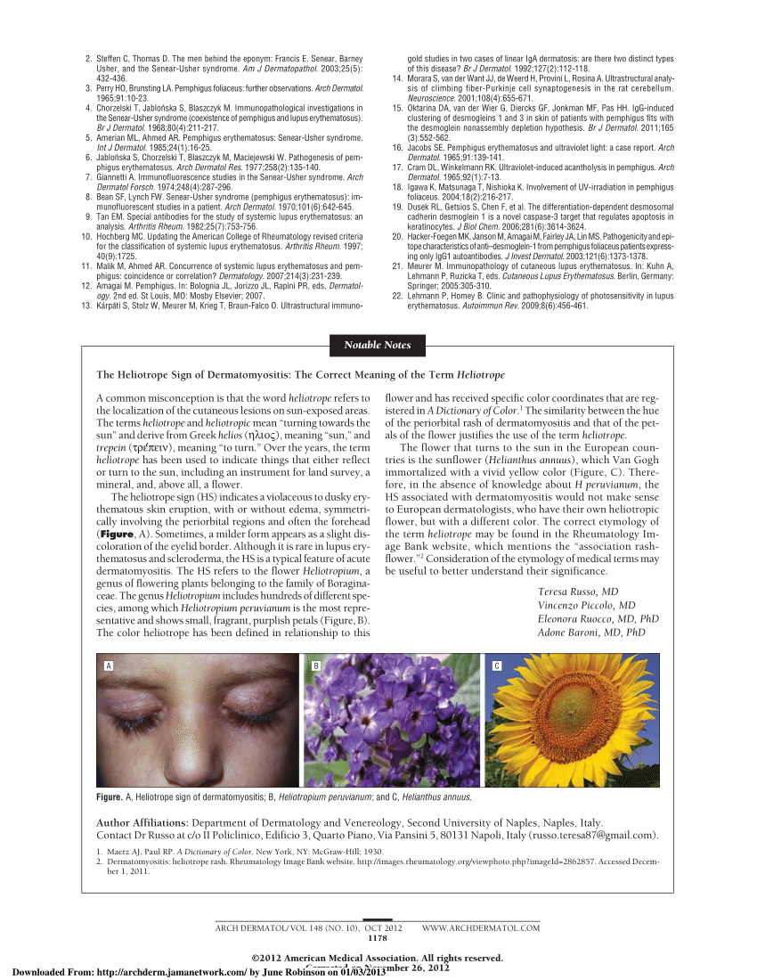 Pdf The Heliotrope Sign Of Dermatomyositis The Correct Meaning Of The Term Heliotrope