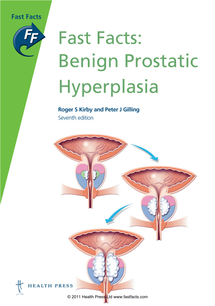 benign prostatic hyperplasia pdf)