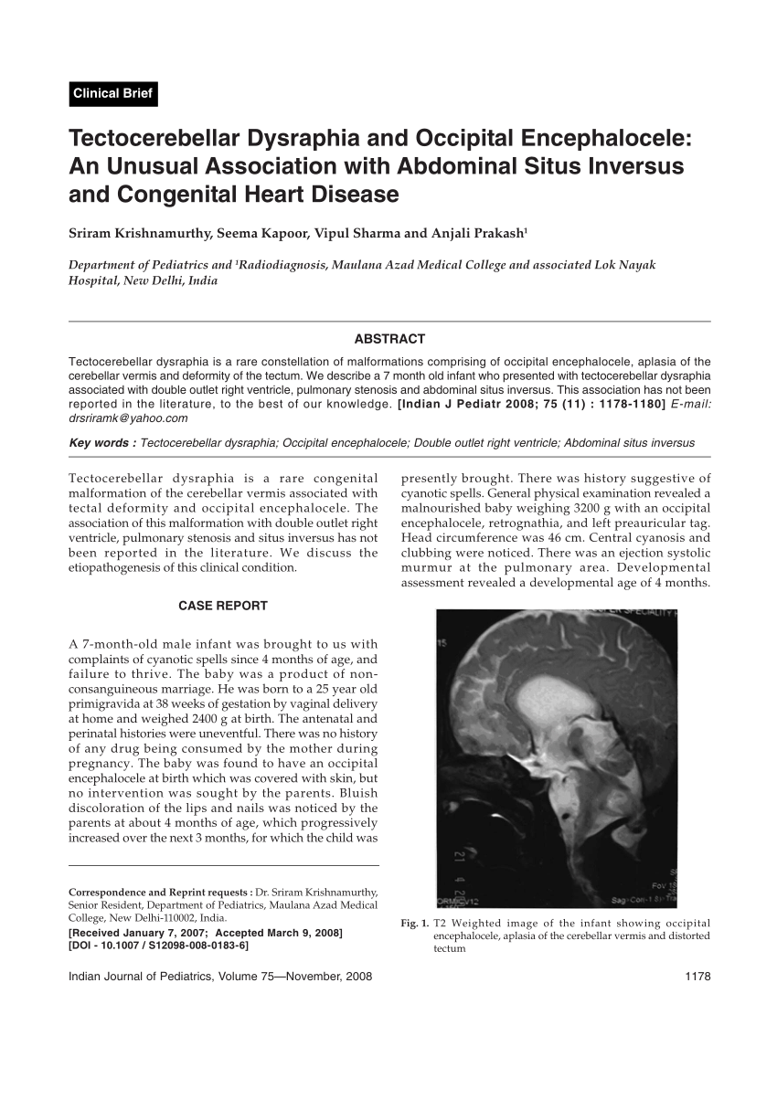 Pdf Tectocerebellar Dysraphia And Occipital Encephalocele An Unusual Association With Abdominal Situs Inversus And Congenital Heart Disease