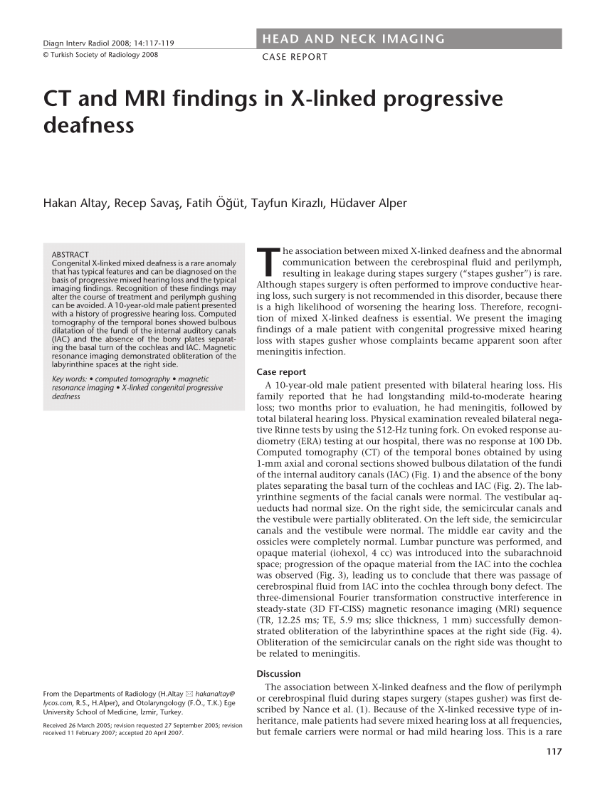 X-Linked Stapes Gusher: CT Findings in One Patient