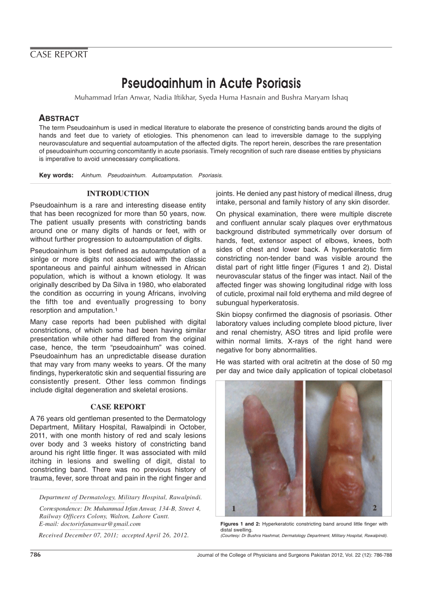 psoriasis treatment in rawalpindi