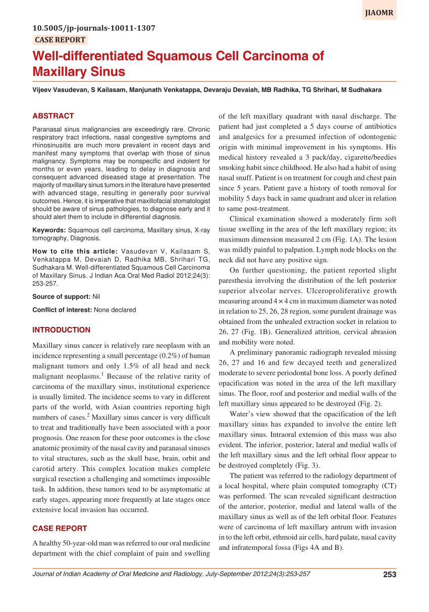 Pdf Well Differentiated Squamous Cell Carcinoma Of Maxillary Sinus