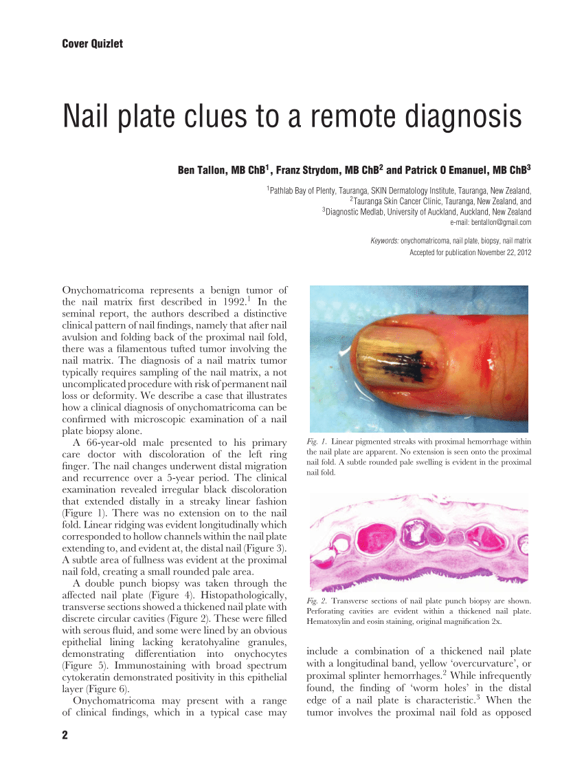 PDF] Pigmented lesions of the nail unit: clinical and histopathologic  features. | Semantic Scholar