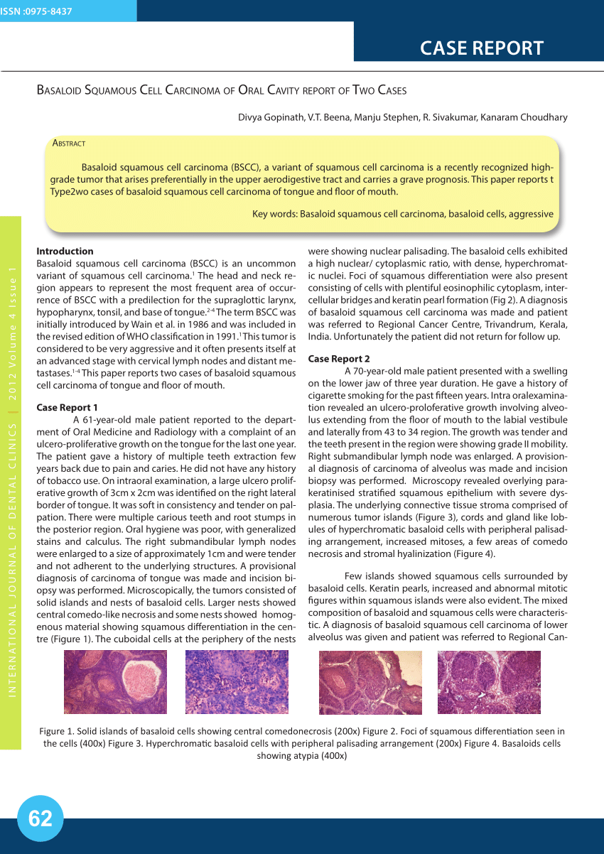 Pdf Basaloid Squamous Cell Carcinoma Of Oral Cavity Report Of Two Cases ...