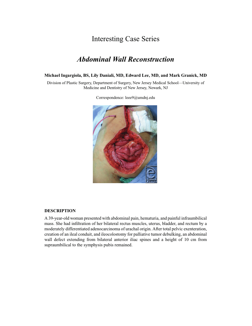 Pdf Abdominal Wall Reconstruction