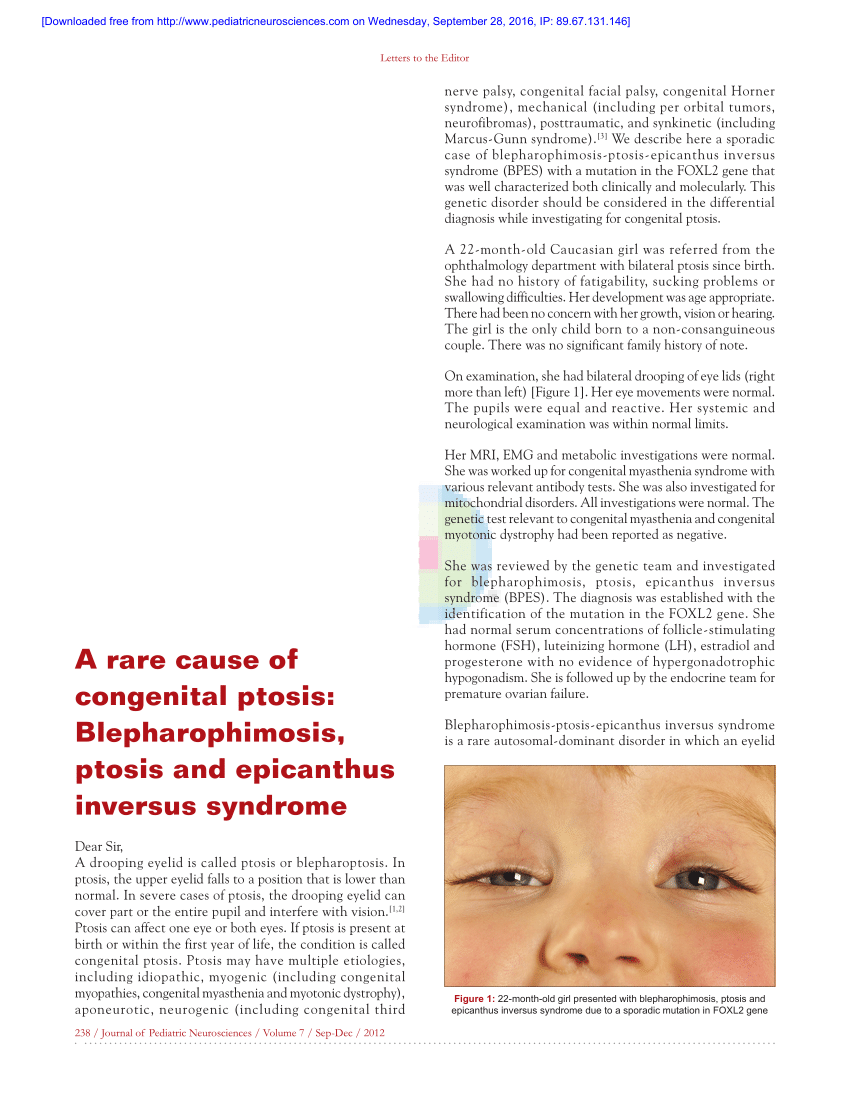 Pdf A Rare Cause Of Congenital Ptosis Blepharophimosis Ptosis And