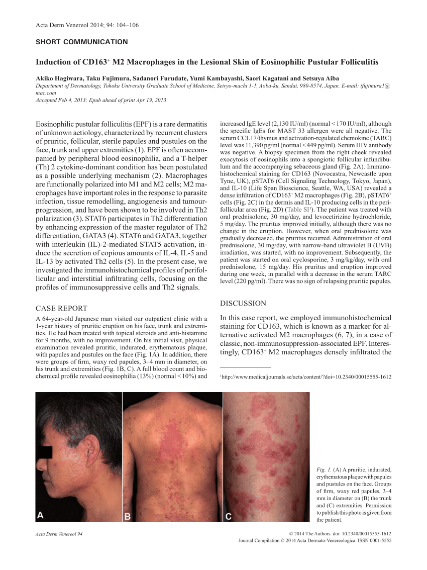 Pdf Induction Of Cd163 M2 Macrophages In The Lesional Skin Of Eosinophilic Pustular 