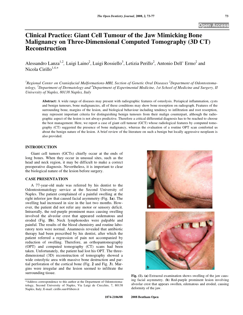(PDF) Clinical Practice: Giant Cell Tumour of the Jaw Mimicking Bone ...