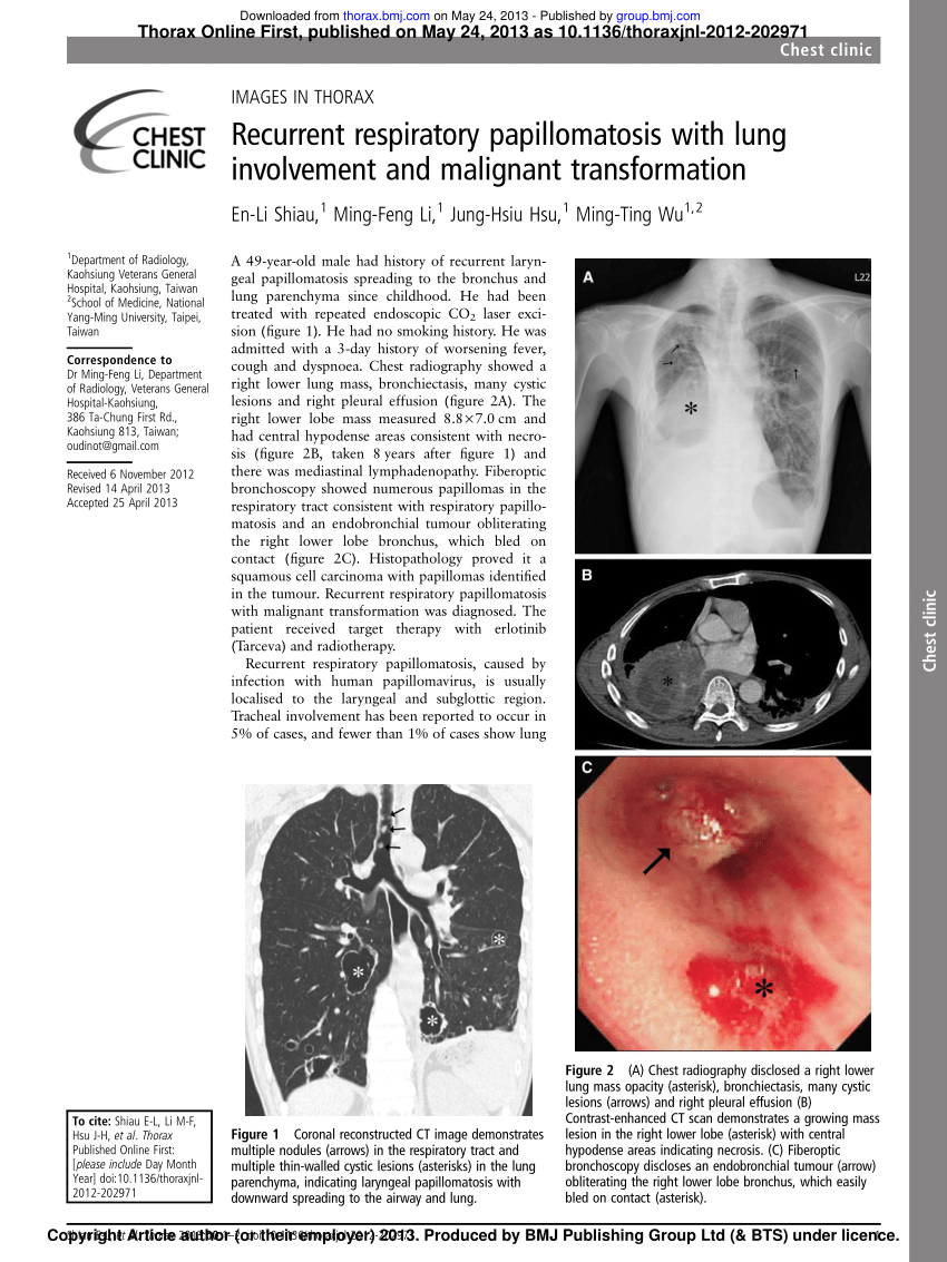 laryngeal papillomatosis in lungs