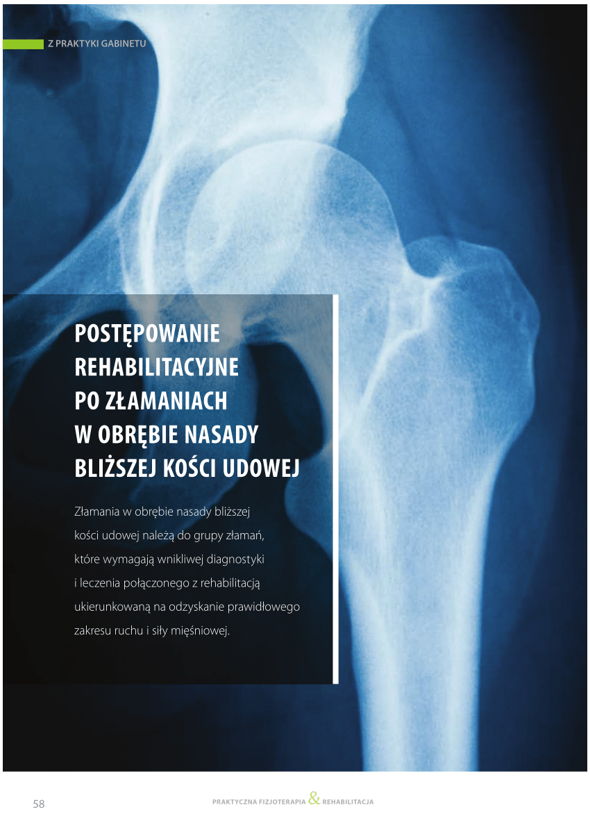 Kretarz Wiekszy Kosci Udowej Palpacja (PDF) Postępowanie rehabilitacyjne po złamaniach w obrębie nasady bliższej kości udowej