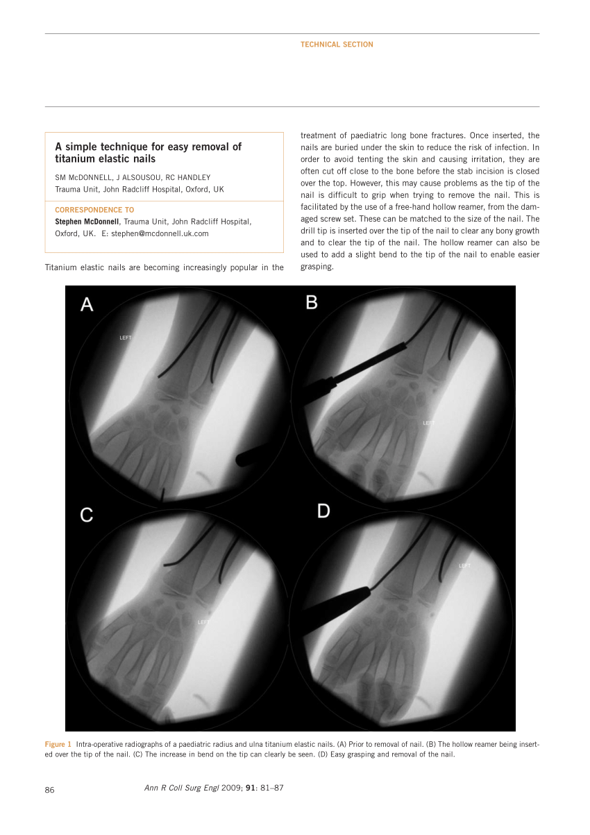 SUTGTielas LJ3231 H | PDF | Arm | Anatomical Terms Of Location