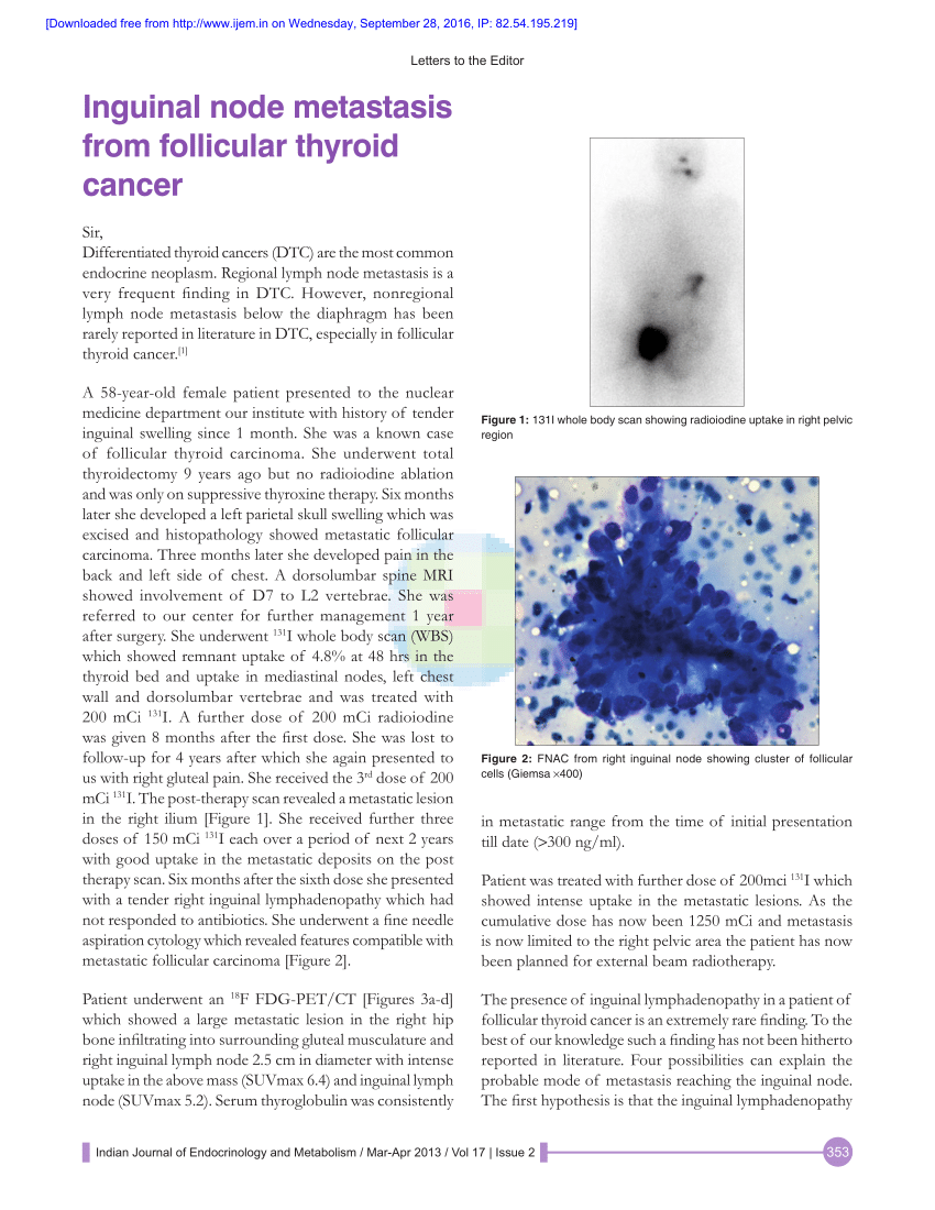 Pdf Inguinal Node Metastasis From Follicular Thyroid Cancer 