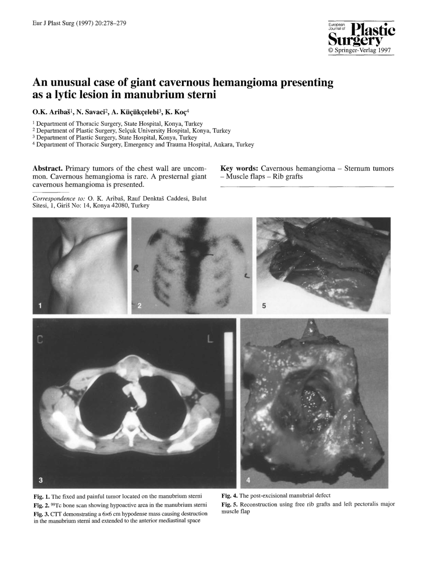 (PDF) An unusual case of giant cavernous hemangioma presenting as a ...