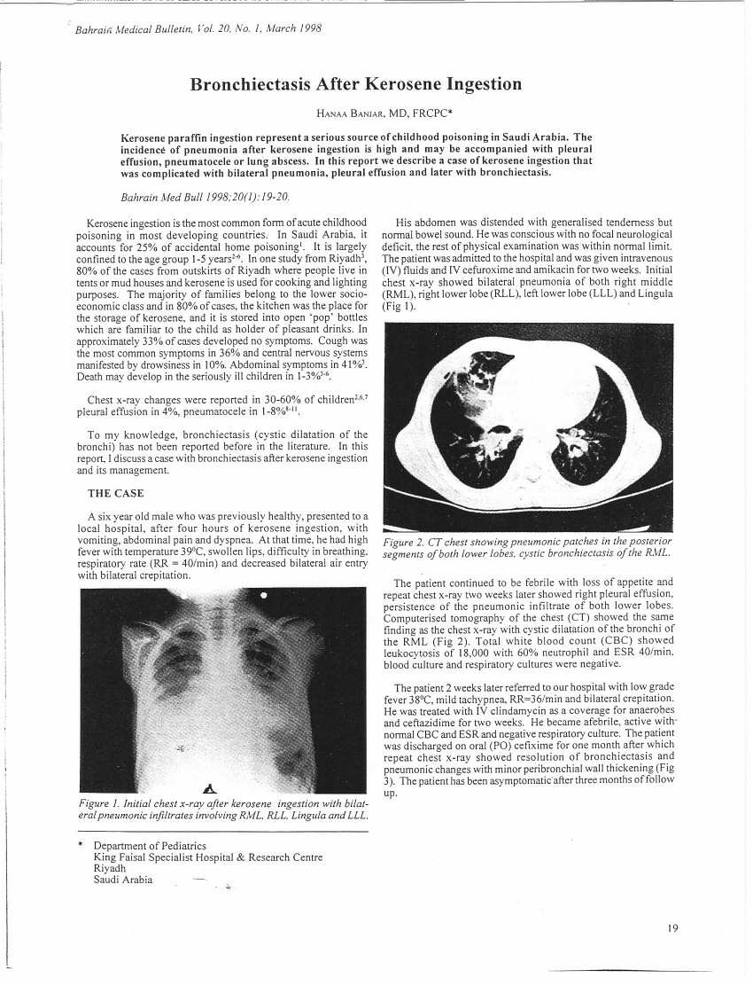 pdf-bronchiectasis-after-kerosene-ingestion