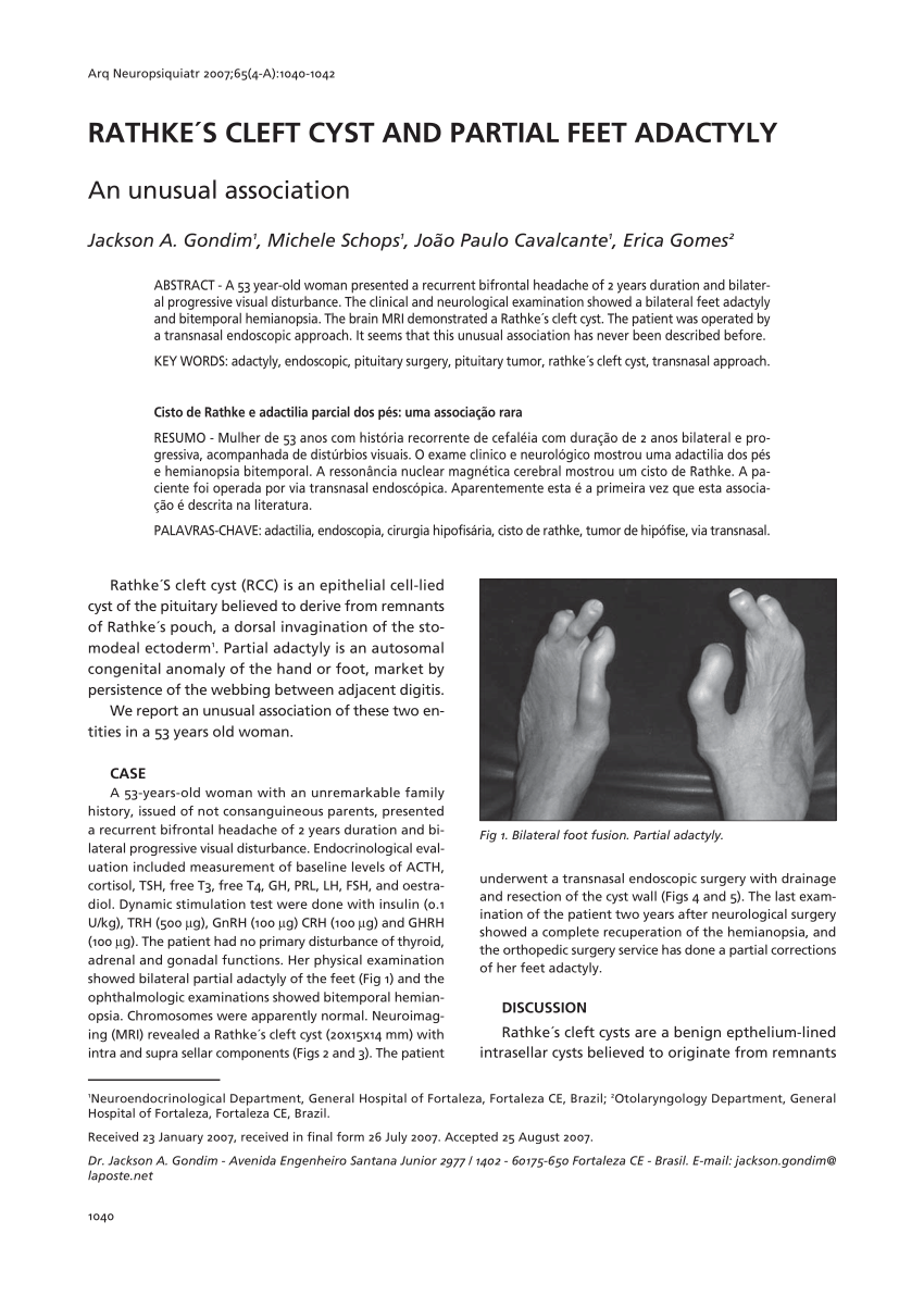 (PDF) RATHKES CLEFT CYST AND PARTIAL FEET ADACTYLY