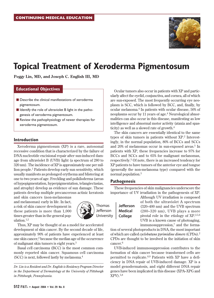 Pdf Topical Treatment Of Xeroderma Pigmentosum