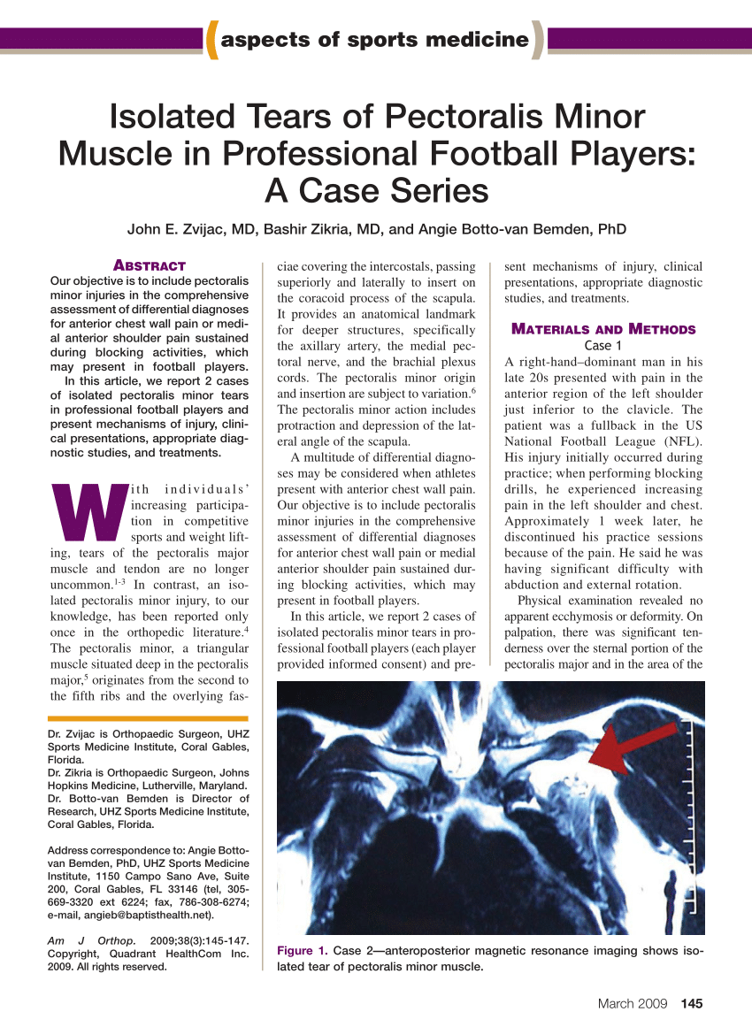 PDF) Isolated tears of pectoralis minor muscle in professional football  players: a case series