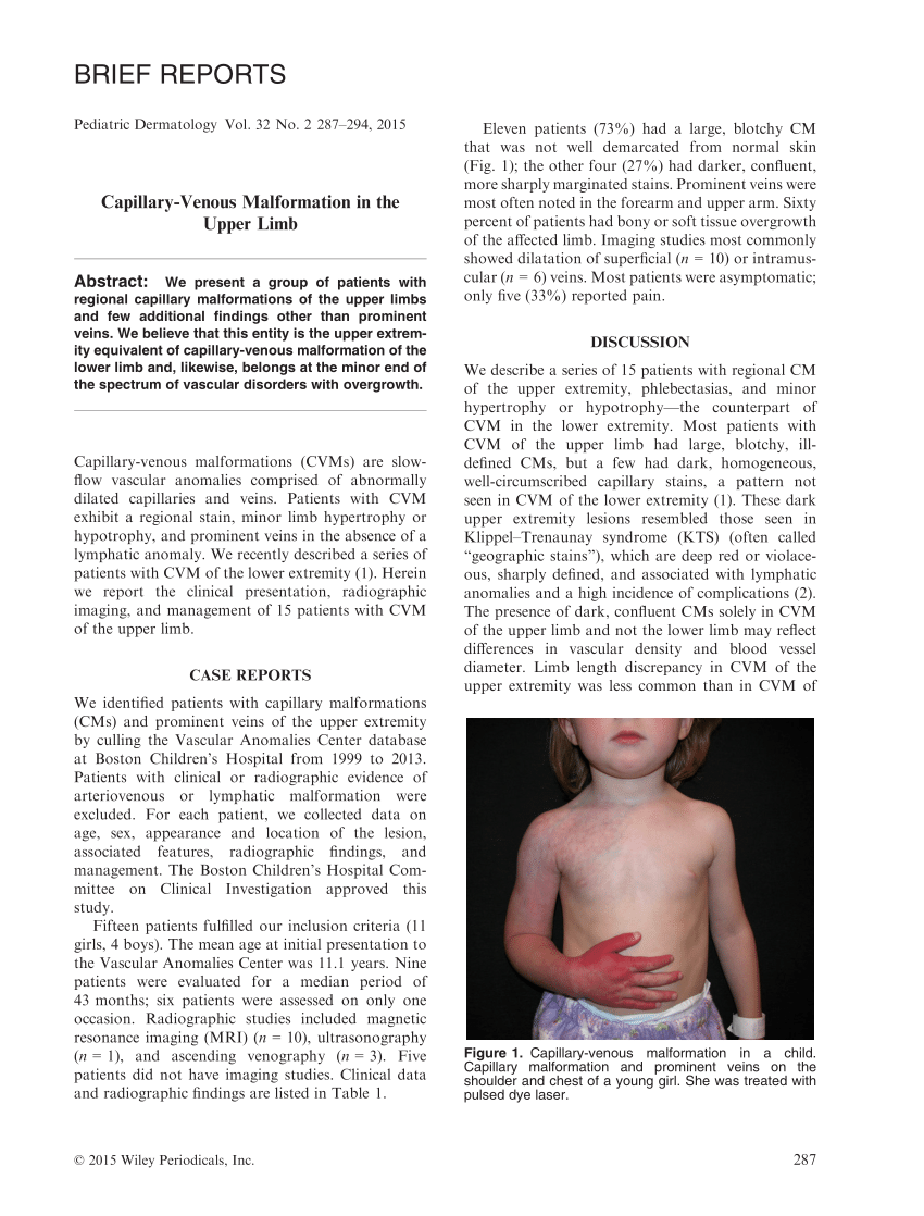 Pdf Capillary Venous Malformation In The Upper Limb