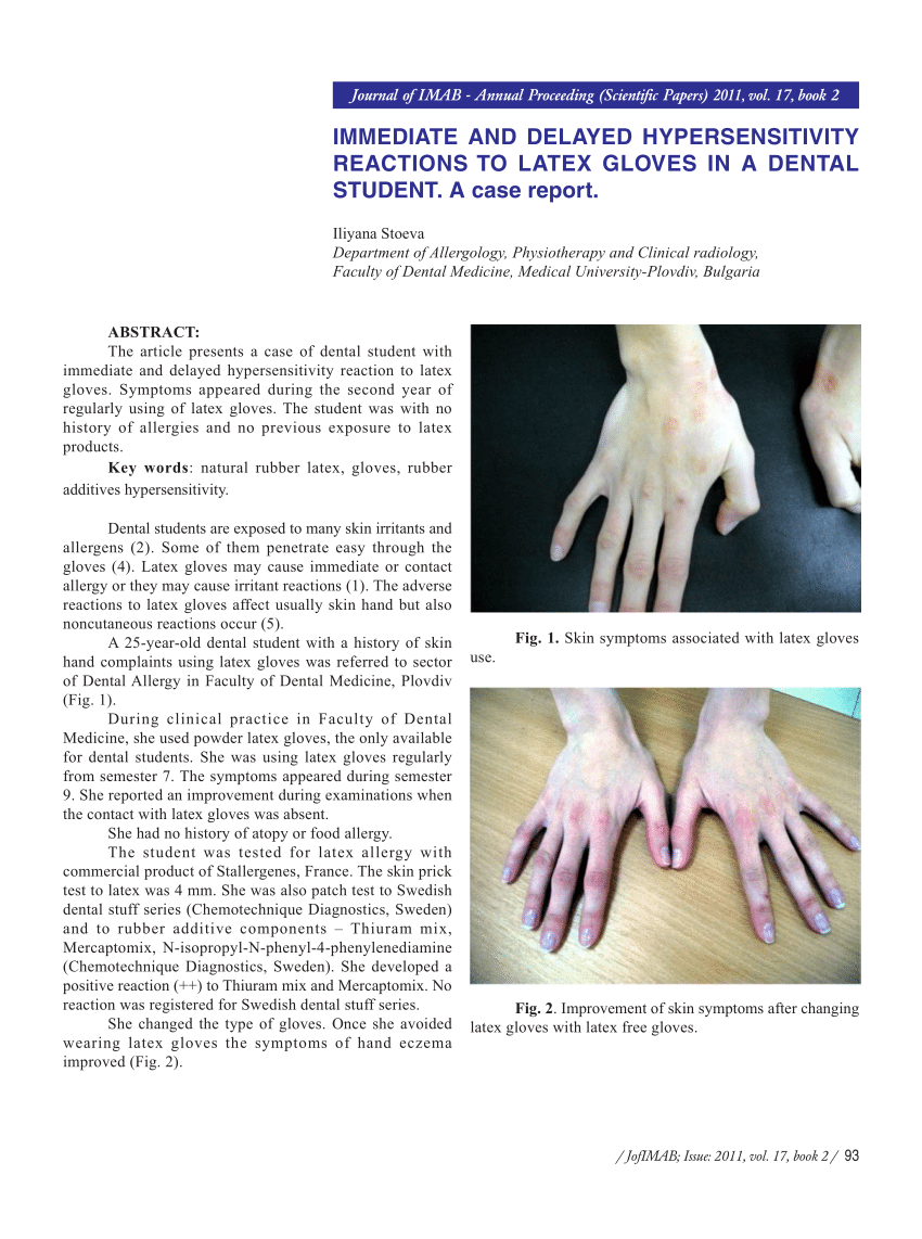 Skin symptoms associated with latex gloves