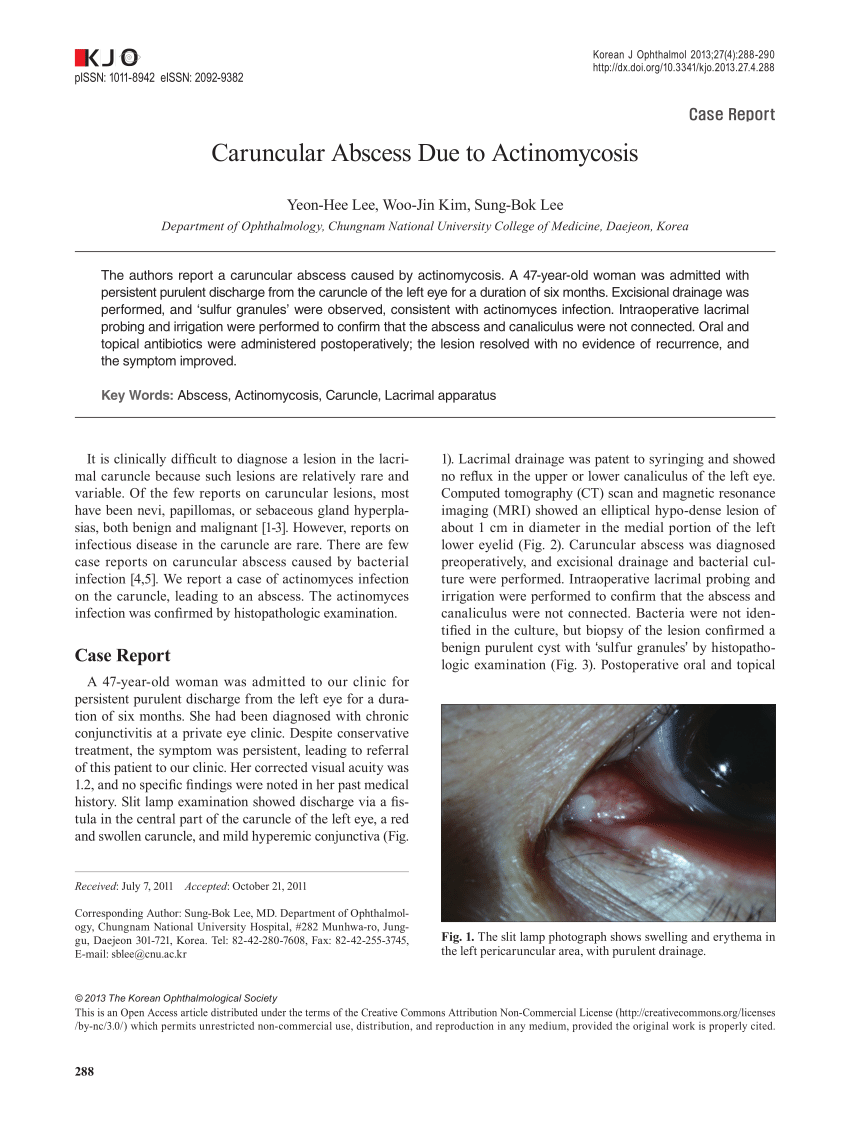 Pdf Caruncular Abscess Due To Actinomycosis