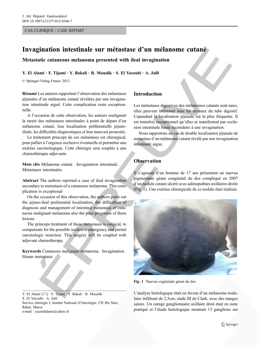 PDF) Invagination intestinale sur métastase d'un mélanome cutané
