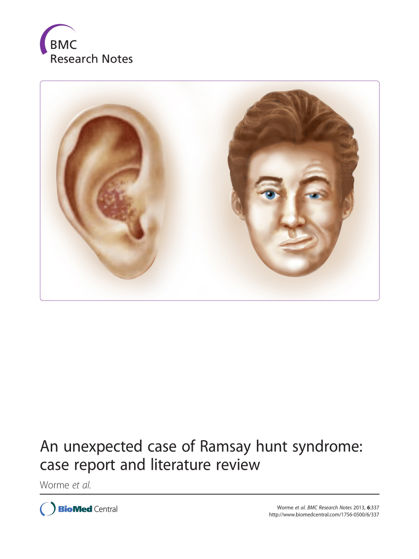 (PDF) An unexpected case of Ramsay hunt syndrome: Case report and