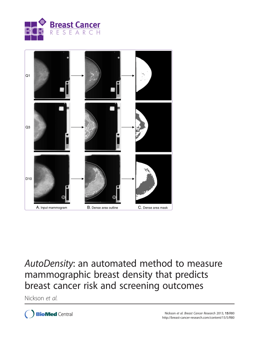 Measuring breast density