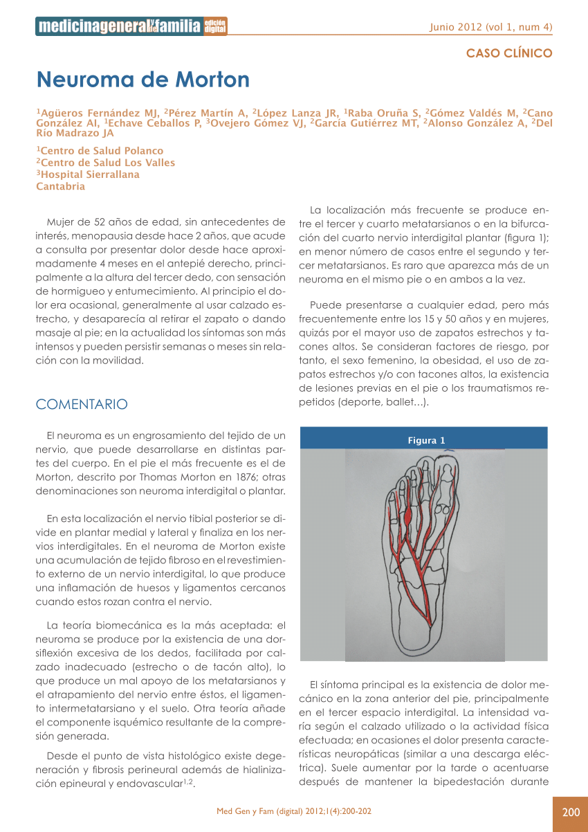 Pdf Neuroma De Morton