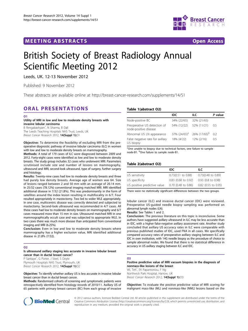 Breast asymmetry: Women in Dorset share their experiences