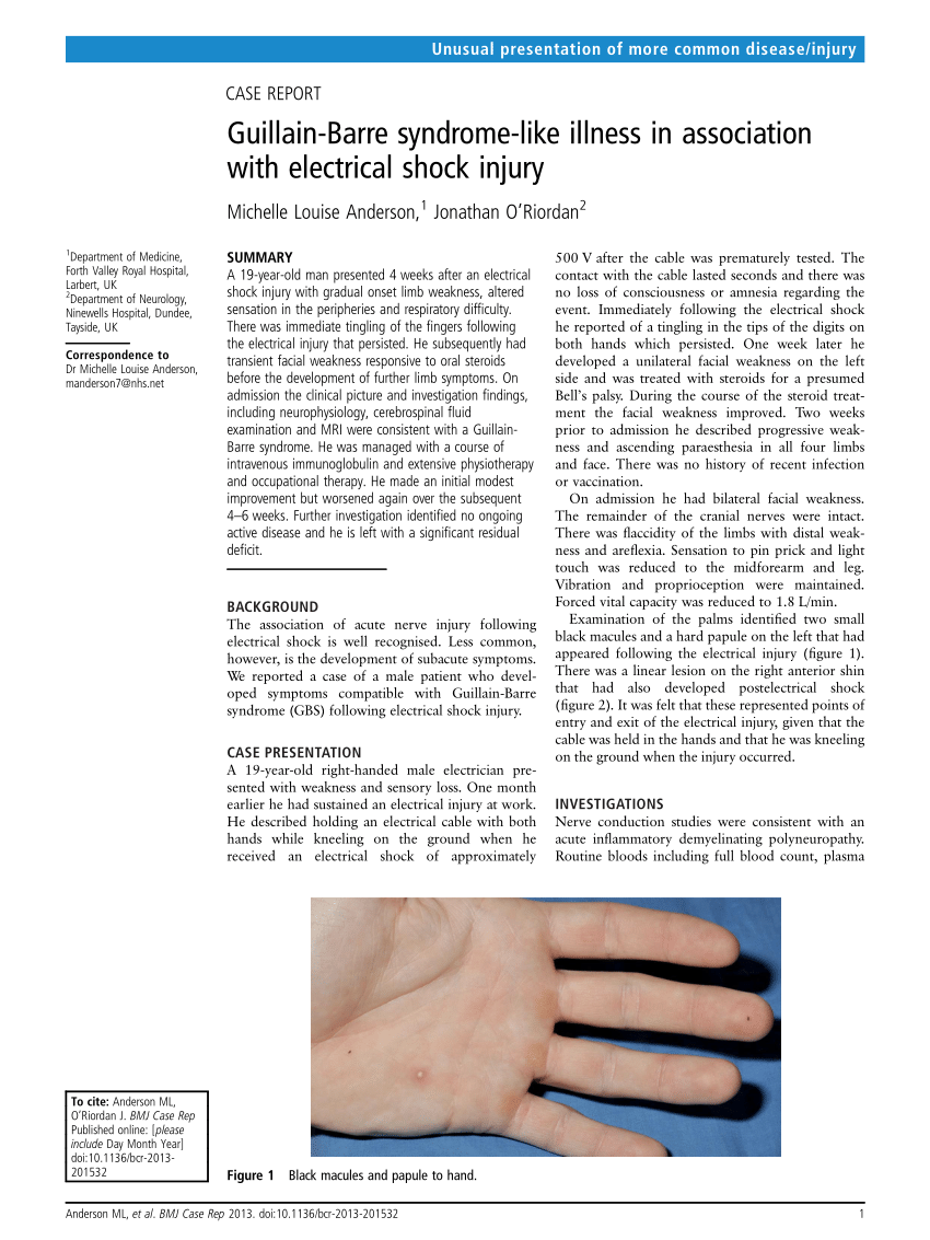 Pdf Guillain Barre Syndrome Like Illness In Association With Electrical Shock Injury