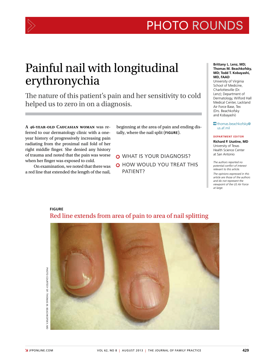 Painful Nail | SpringerLink