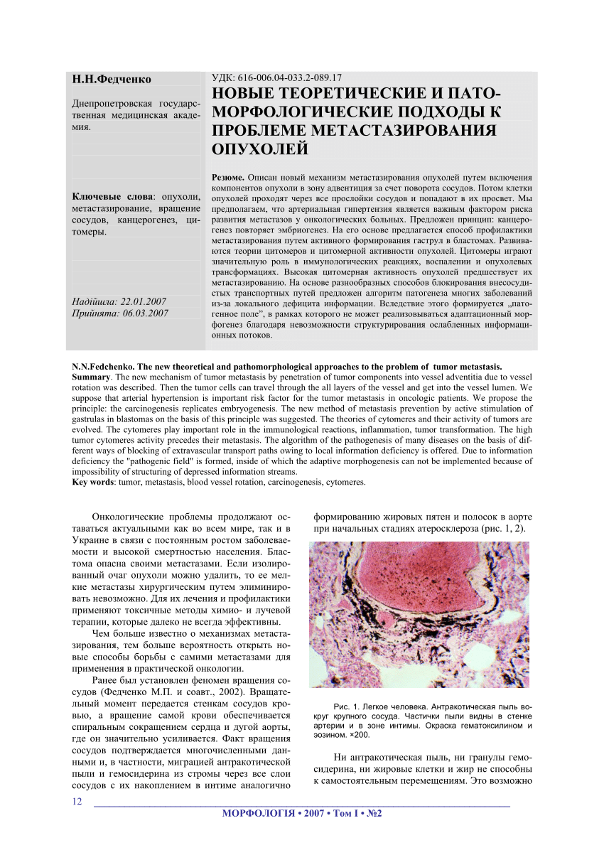 PDF) НОВЫЕ ТЕОРЕТИЧЕСКИЕ И ПАТОМОРФОЛОГИЧЕСКИЕ ПОДХОДЫ К ПРОБЛЕМЕ  МЕТАСТАЗИРОВАНИЯ ОПУХОЛЕЙ