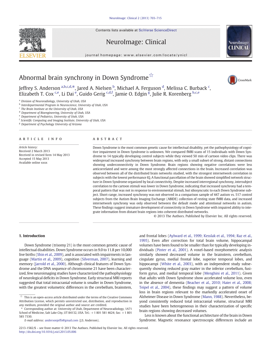 PDF) Abnormal brain synchrony in Down Syndrome