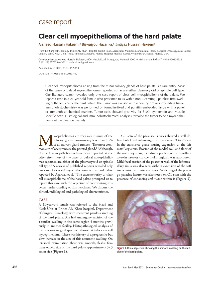 Pdf Clear Cell Myoepithelioma Of The Hard Palate