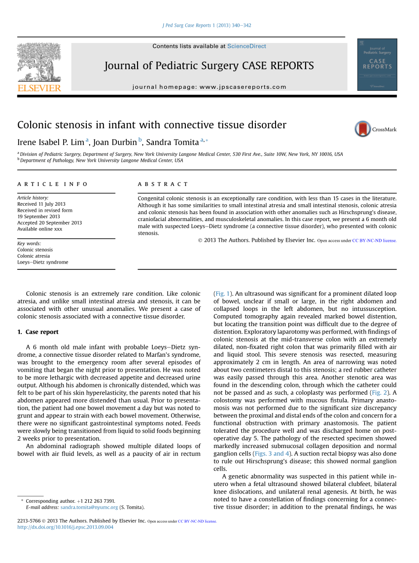 (PDF) Colonic stenosis in infant with connective tissue disorder