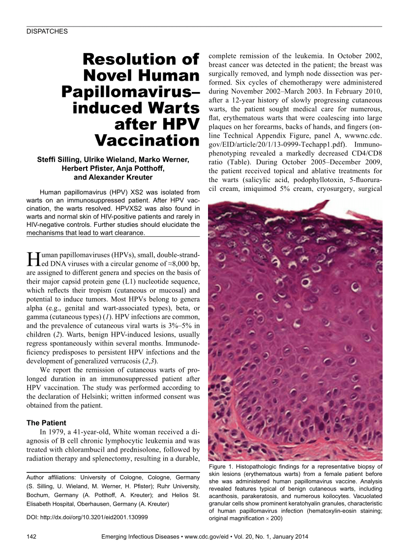 human papillomavirus vaccine after infection)