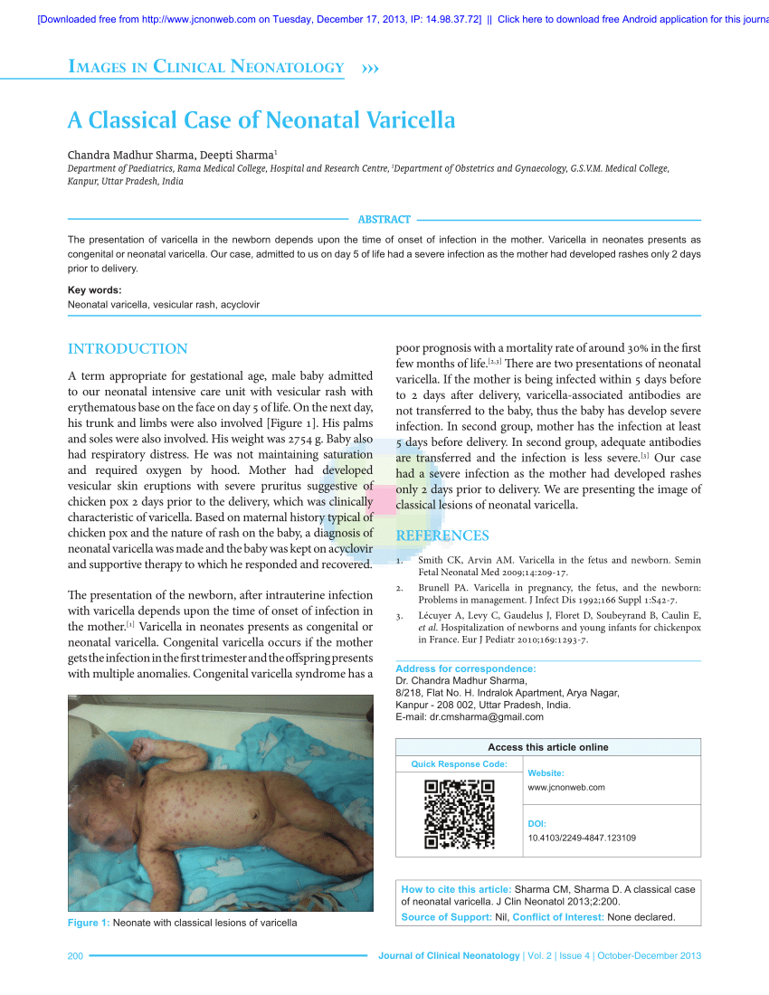 neonatal varicella