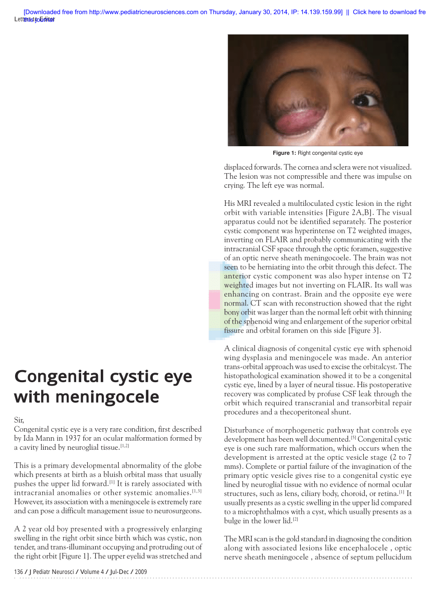 diagnostic de vedere congenital