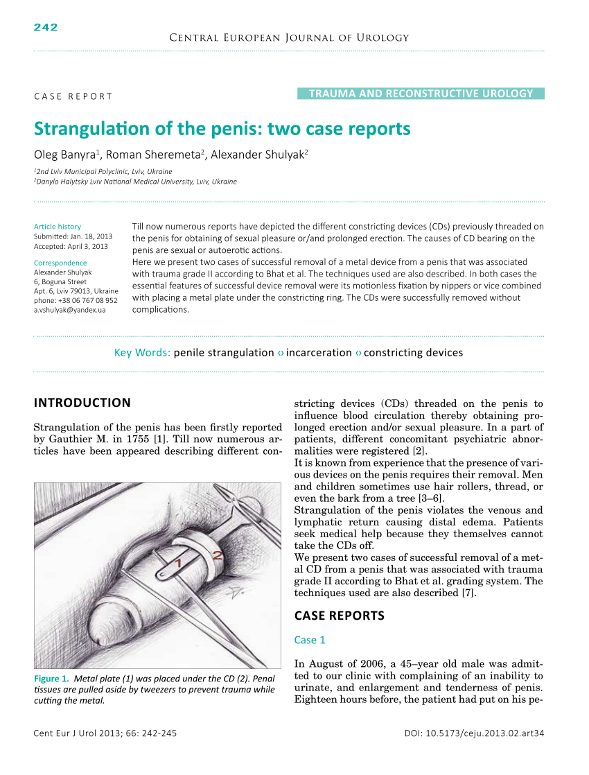 PDF Strangulation of the penis Two case reports