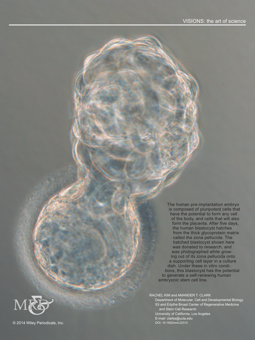 Pdf Hatching Human Blastocyst