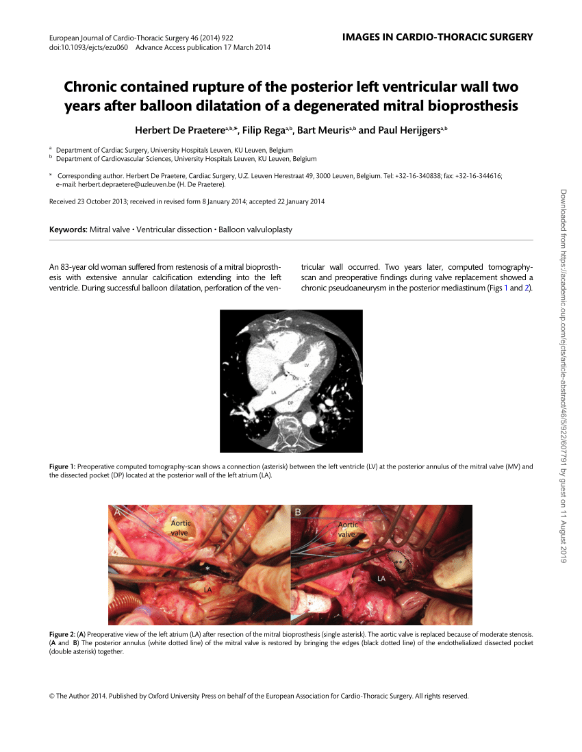 Pdf Chronic Contained Rupture Of The Posterior Left Ventricular