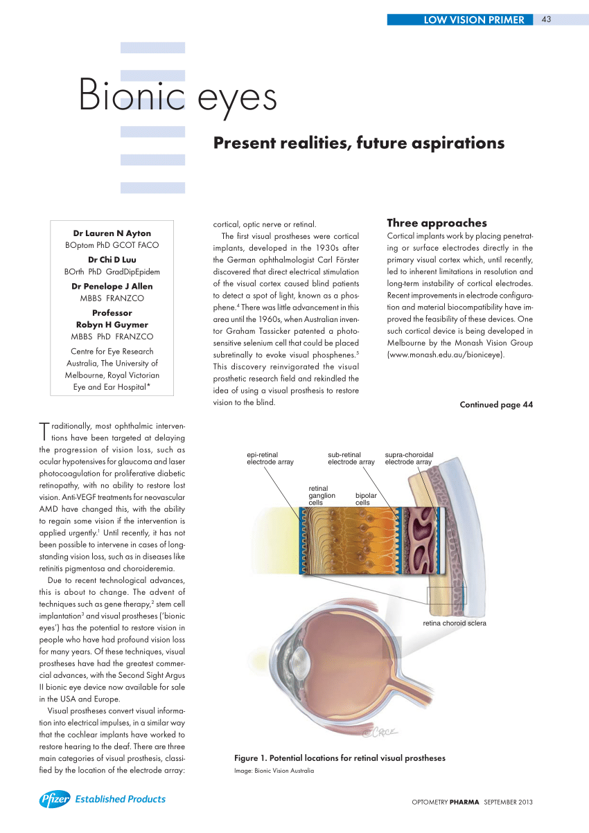 Pdf Bionic Eyes Present Realities And Future Aspirations