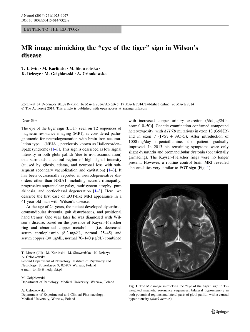 Pdf Mr Image Mimicking The Eye Of The Tiger Sign In Wilson S Disease