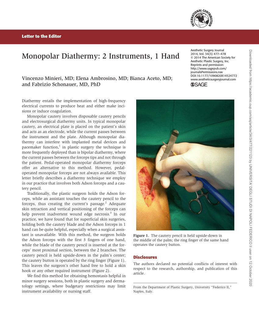 Types of Electrocautery & Principles of its use in Thermocoagulation