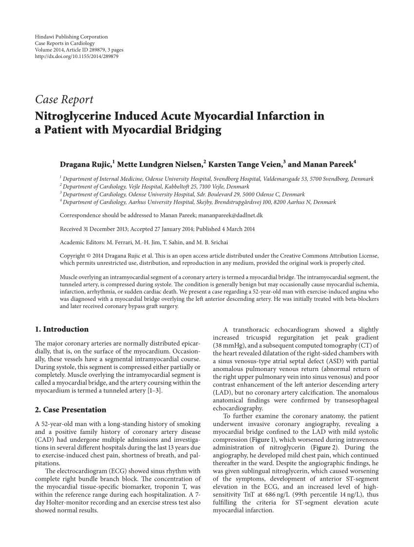 research article of myocardial infarction