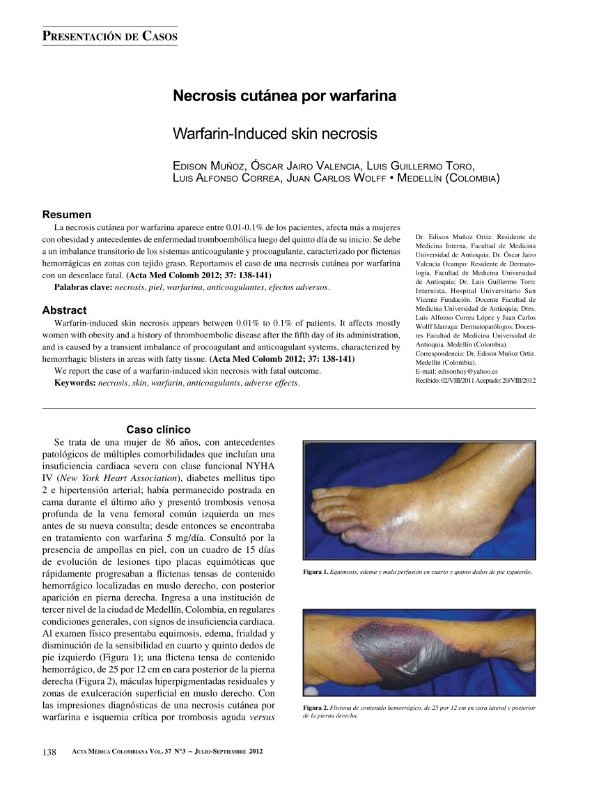 Pdf Warfarin Induced Skin Necrosis 4433