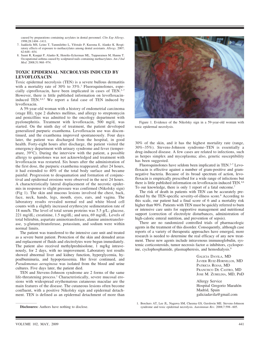 Pdf Toxic Epidermal Necrolysis Induced By Levofloxacin