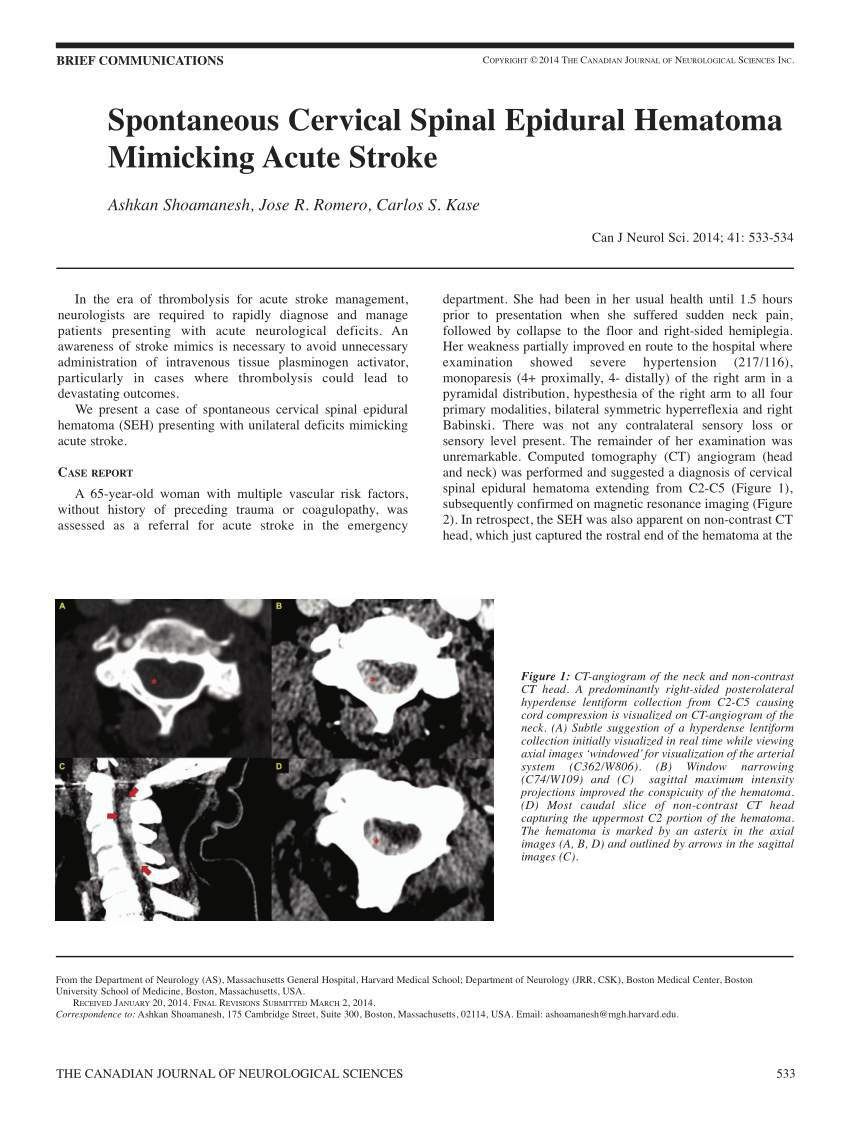 Pdf Spontaneous Cervical Spinal Epidural Hematoma Mimicking Acute