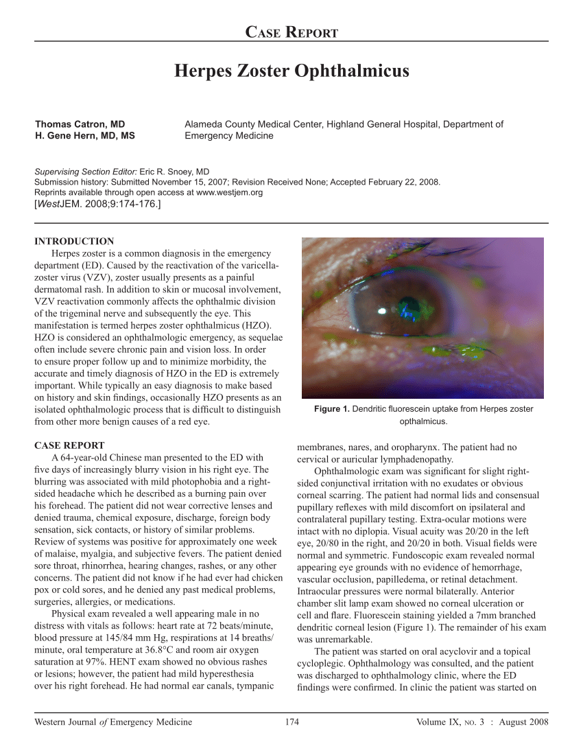 Pdf Herpes Zoster Ophthalmicus