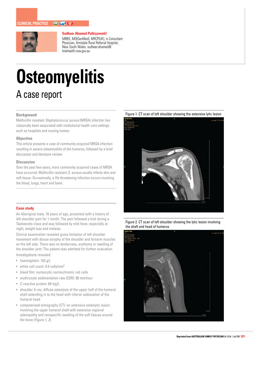 osteomyelitis case study scribd